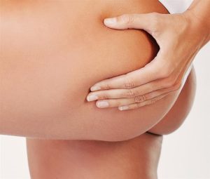 L’effetto del collagene VERISOL® sulla cellulite
