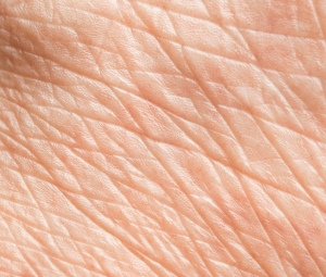 L’effetto del collagene VERISOL® sulle rughe
