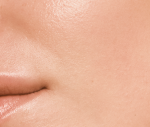 L’effetto del collagene VERISOL® sulla pelle